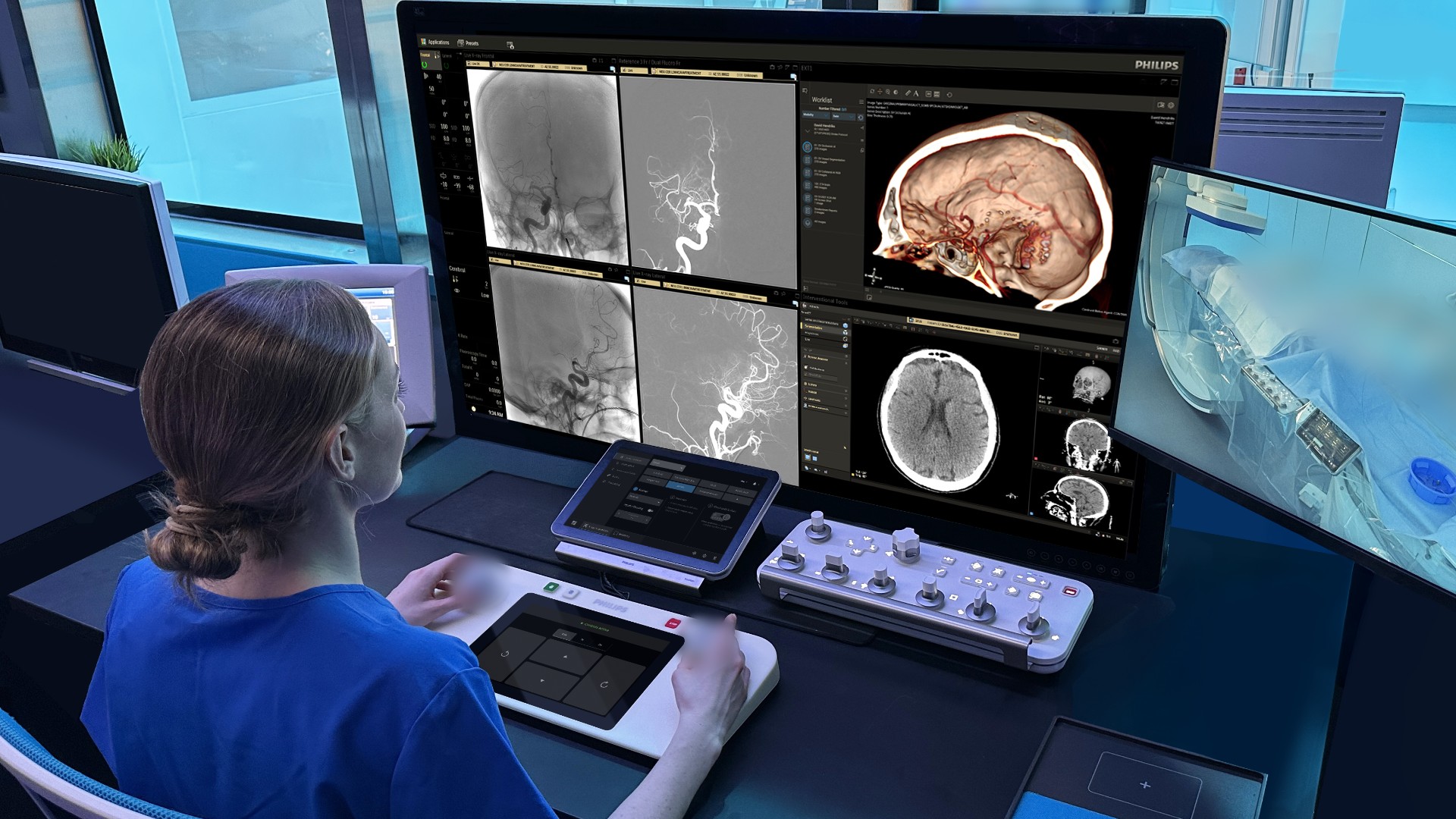 Philips selected for ARPA-H program to advance AI-enabled robotic stroke care